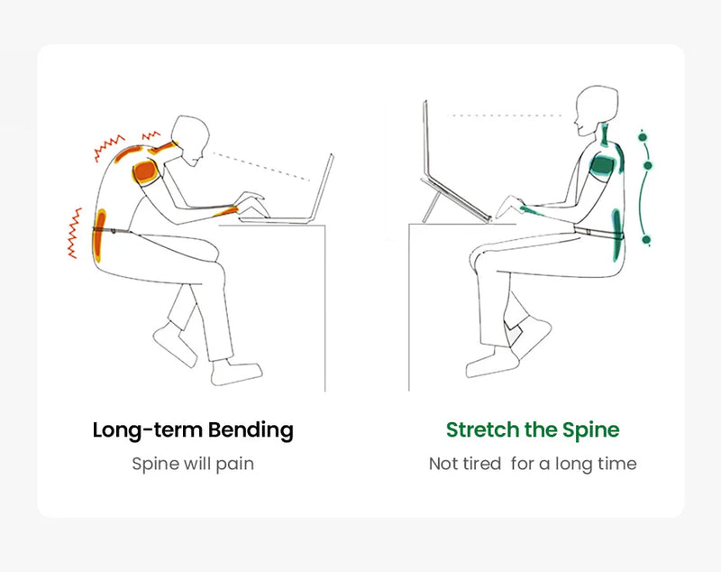 UGREEN Adjustable Aluminum Laptop Stand – Foldable & Portable (Up to 17.3”)
